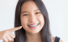 Orthodontics 101: Straightening Your Teeth With Expert Care